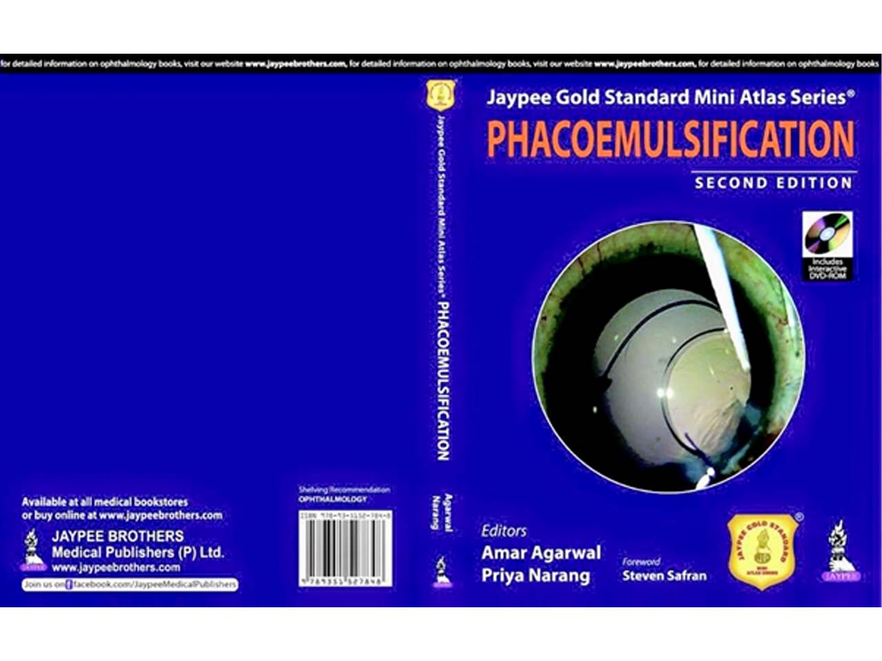 Cataract Surgery Vijay Cross Road  
