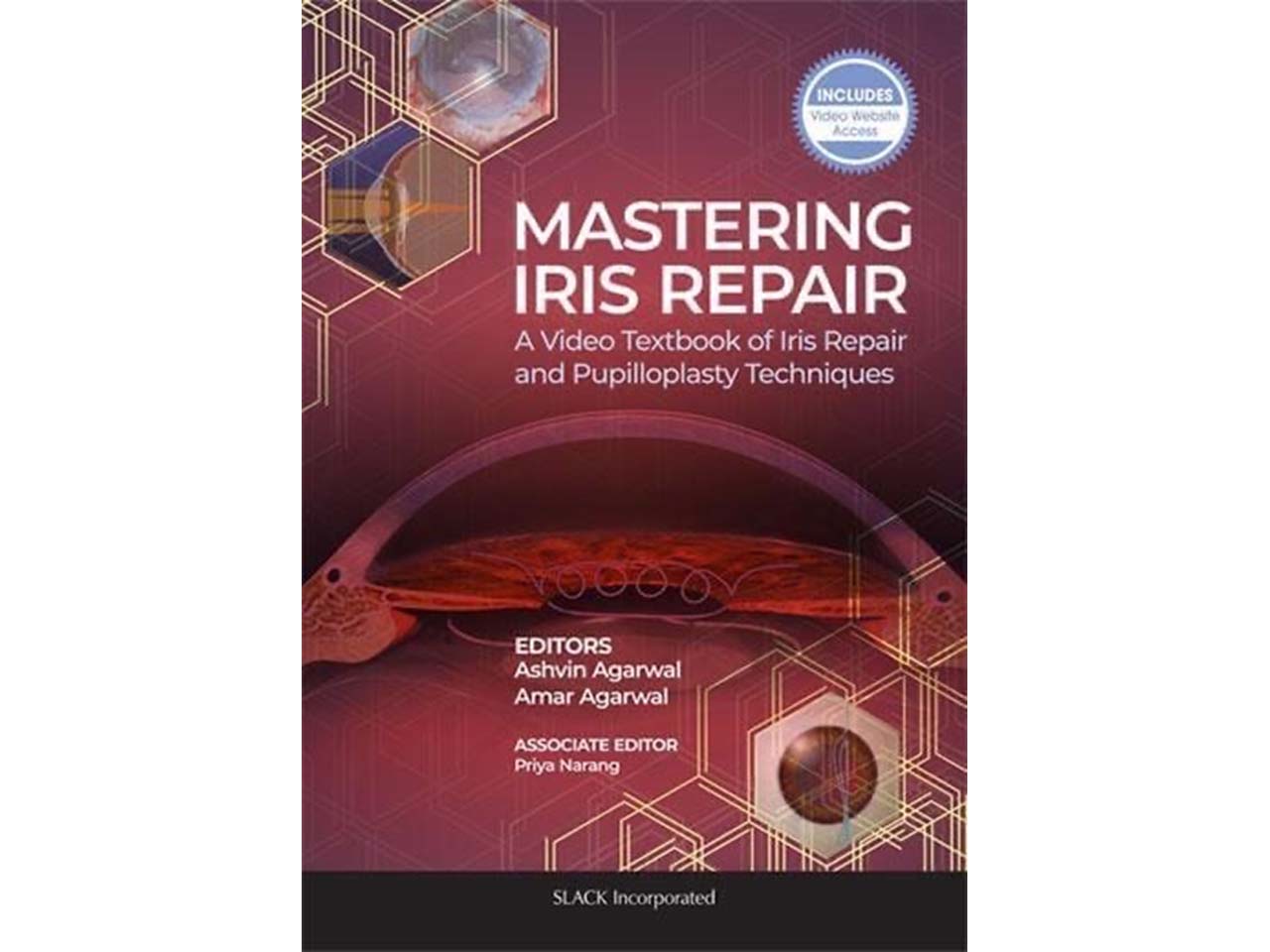 Cataract Surgery Ahmedabad  
